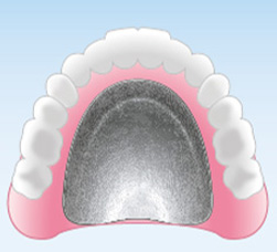 金属床義歯（自由診療の総入れ歯）