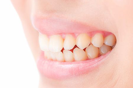 かみ合わせの重要性