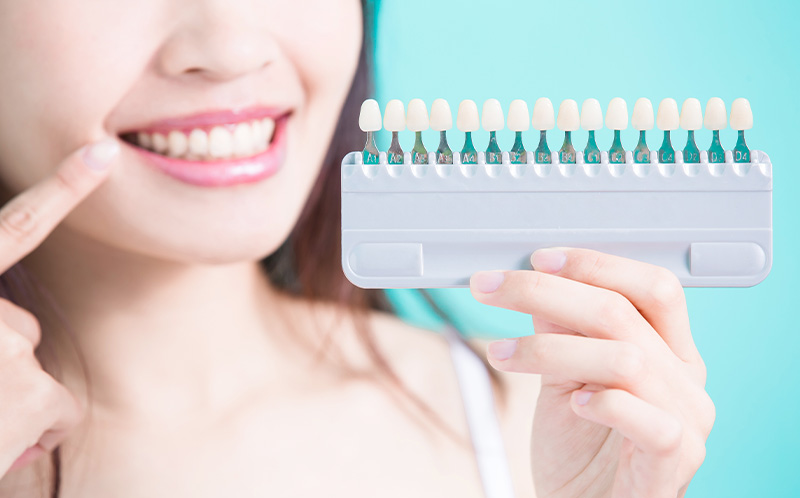 ホワイトニング